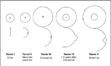 teen nippel|Normal Breast Development and Changes